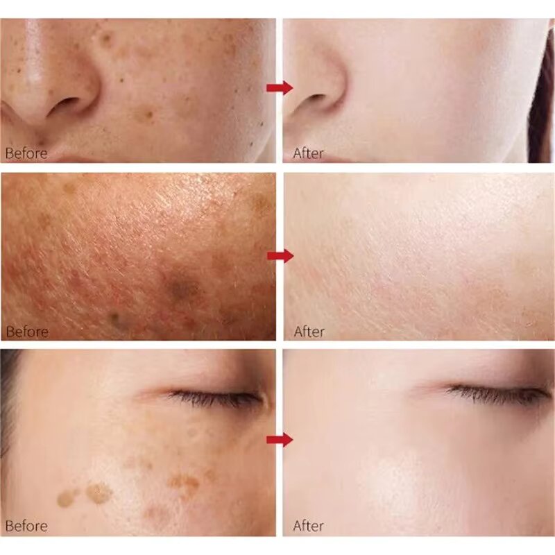 Peach 70% Niacinamide Serum hydrating face serum daily clean beauty