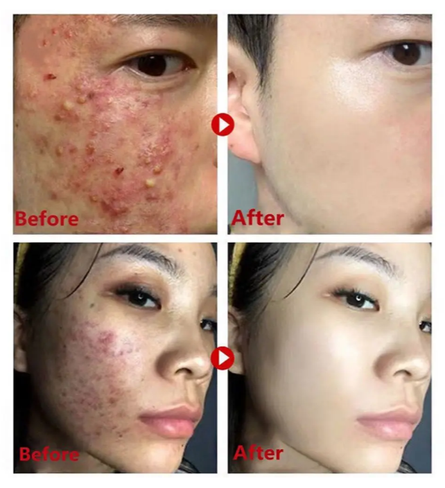 Green Tea Mask Stick Remove Blackheads