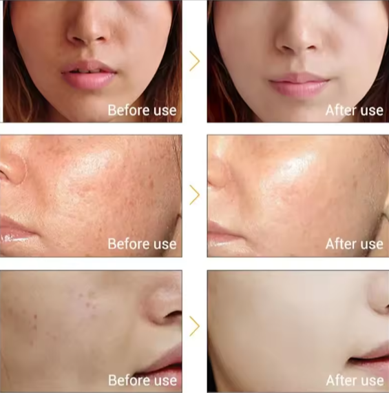 Electric Facial Beauty Device Ultrasonic Ionic Face Cleaner Anti-aging Machine High Frequency Wrinkle Removal Skin Lift Massager