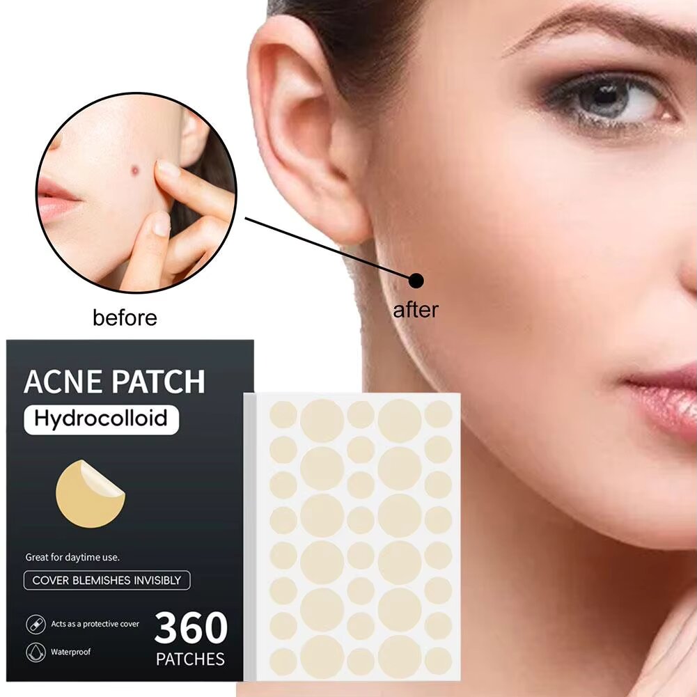 Acne Pimple Patch Stickers Acne Pimple Remover Tool Absorb Pus And Oil