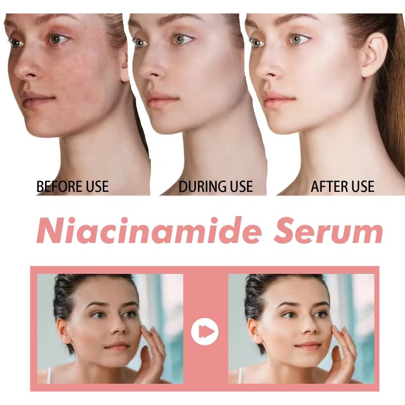 Peach 70% Niacinamide Serum hydrating face serum daily clean beauty