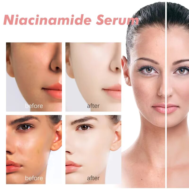 Peach 70% Niacinamide Serum hydrating face serum daily clean beauty